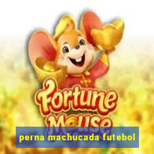 perna machucada futebol